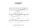 Профлист Металл Профиль МП-20x1100-R (VALORI-20-DarkGrey-0,5)